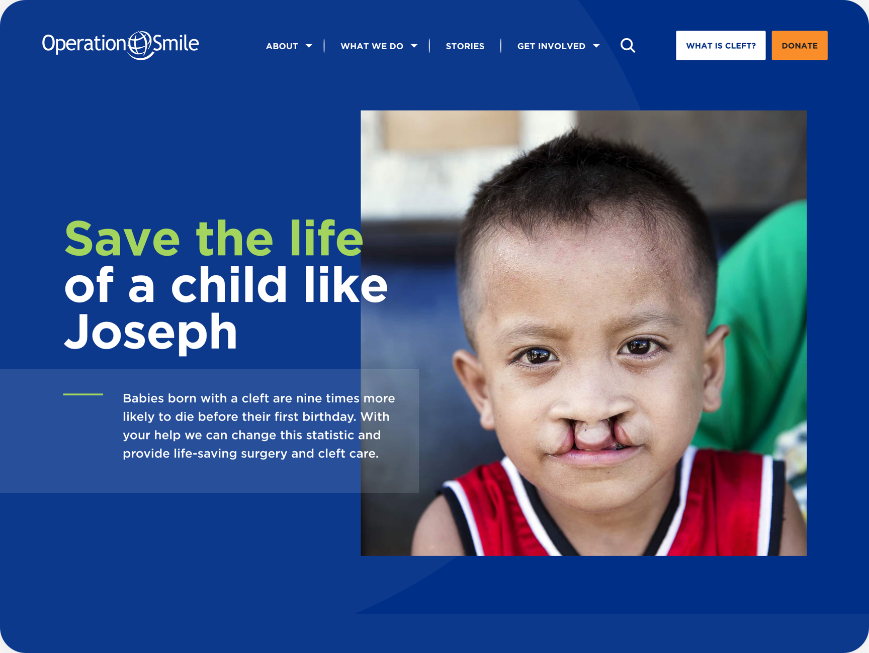 Image of Operation Smile's new homepage.